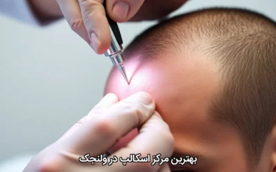 بهترین مرکز اسکالپ در ولنجک